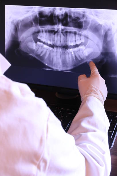 Best Emergency Dental Care for Broken or Chipped Teeth in North Spearfish, SD